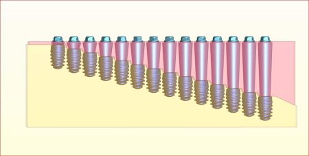 MultiunityNarrow 2 .JPG